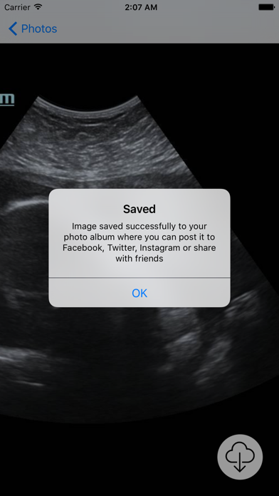 How to cancel & delete Your Baby Scan - Photo Locker from iphone & ipad 4