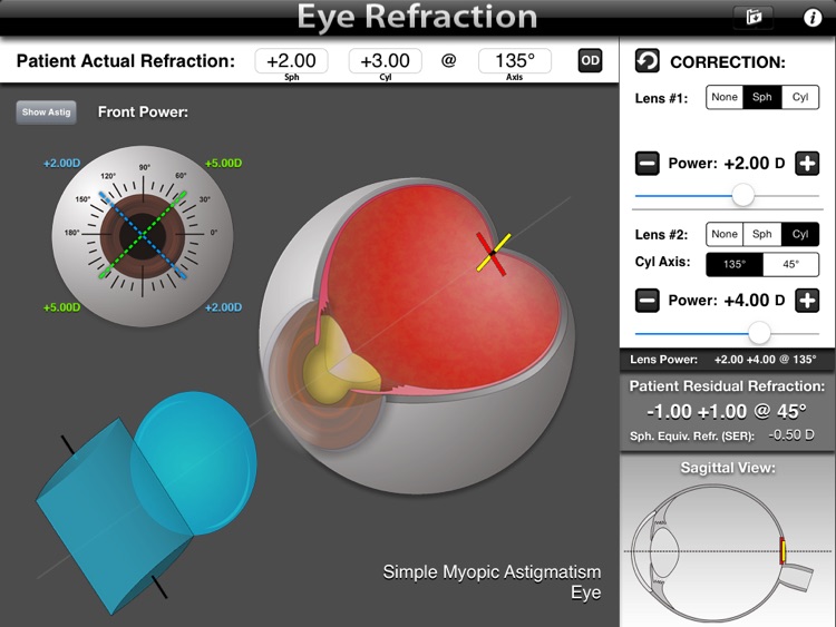 Eye Refraction screenshot-3