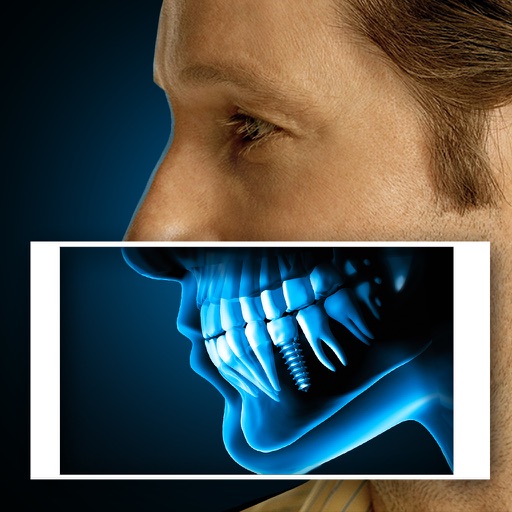 X-Ray Human Teeth Joke iOS App