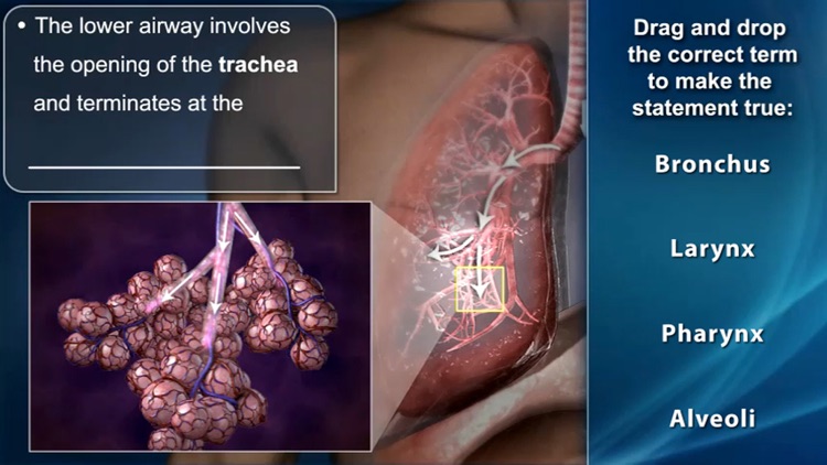 Medrills: Pediatric Medical Emergencies screenshot-3