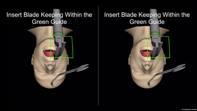 How to cancel & delete Laryngoscopy AR from iphone & ipad 3