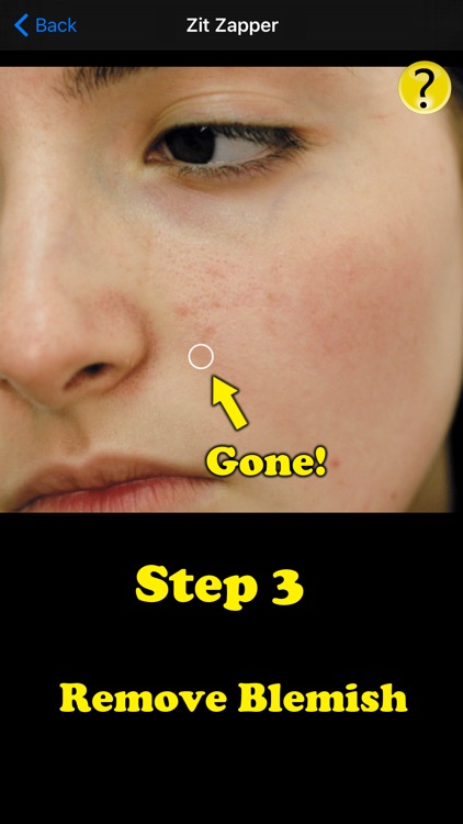 Zit Zapper Pro - Airbrush your face and remove pimples and acne screenshot-3