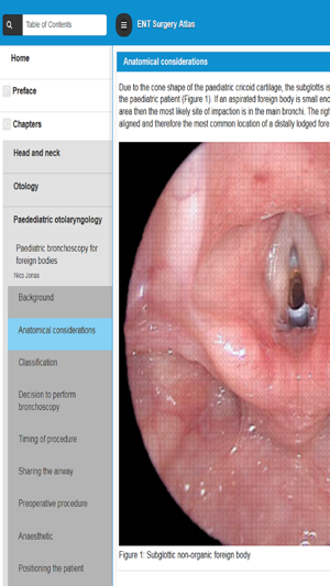 ENT Surgery Atlas(圖1)-速報App