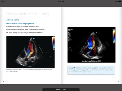 Ultrasound POC Education - Philips screenshot 4