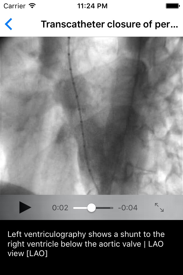 CARDIO3® Atlas of Interventional Cardiology – Lite screenshot 4