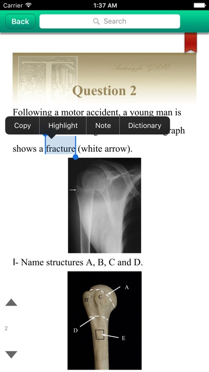 Anatomy For GSSE  for iPhone