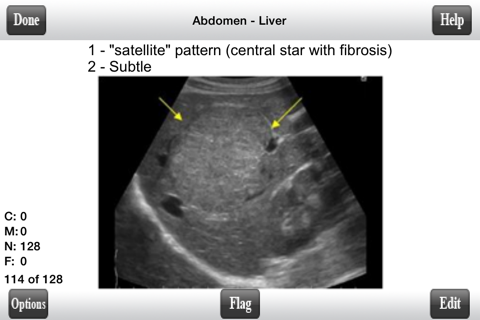 ARRT Sonography (Ultrasound) Flashcards Lite screenshot 2