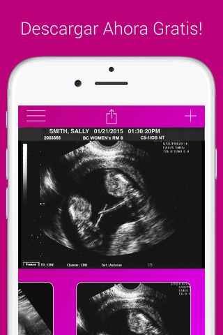 Ultrasound Prank Free - Pregnant Spoof And Fake Pregnancy Trick screenshot 4