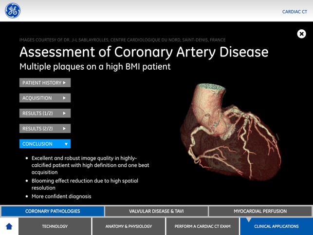 Cardiac Imaging(圖5)-速報App