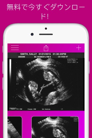 Ultrasound Prank Free - Pregnant Spoof And Fake Pregnancy Trick screenshot 4