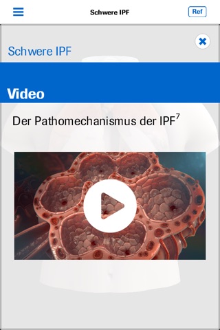 Roche IPF screenshot 4