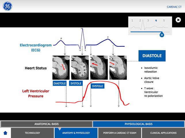 Cardiac Imaging(圖3)-速報App