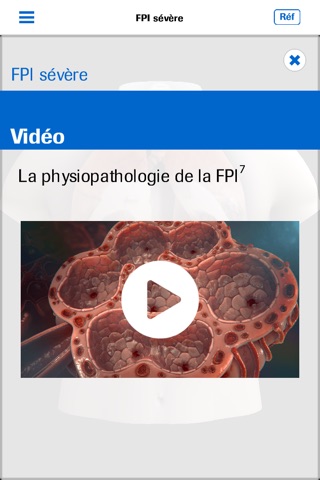 Roche IPF screenshot 4
