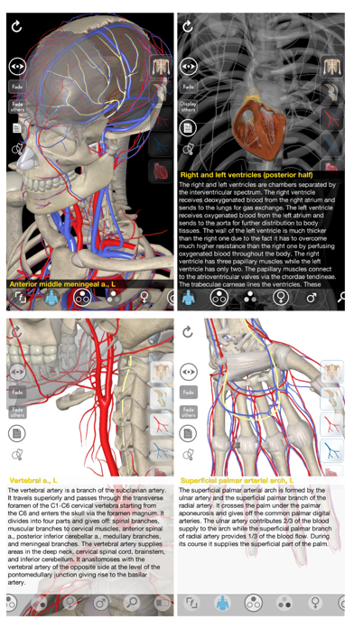 How to cancel & delete 3D Organon Anatomy - Heart, Arteries, and Veins from iphone & ipad 1