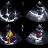 Echocardiography Glossary and Cheatsheet: Study Guide and Courses