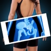 Xray Scanner Hip Bone Prank
