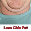 Lose Chin Fat