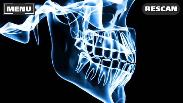 Xray Scanner Teeth Prank(圖2)-速報App