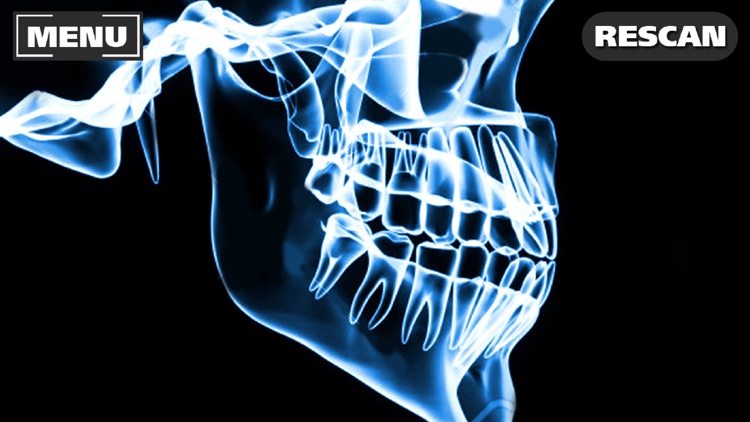 Xray Scanner Teeth Prank