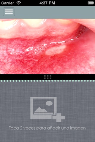 OralmeDX screenshot 3