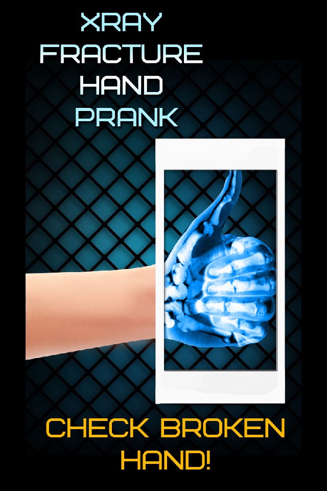 Xray Fracture Hand Prank screenshot 3