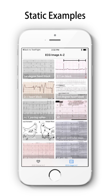 ECG A-Z Pro