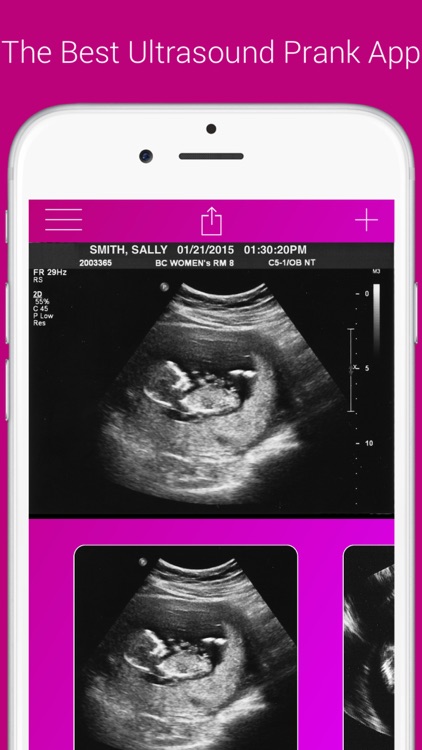 Ultrasound Prank Free - Pregnant Spoof And Fake Pregnancy Trick