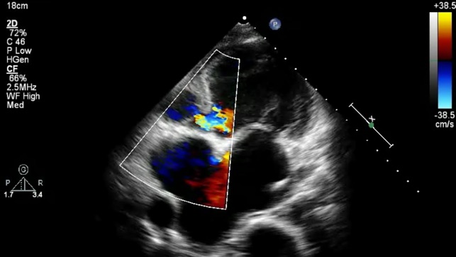 CARDIO3® Comprehensive Atlas of Echocardiography - Lite(圖5)-速報App