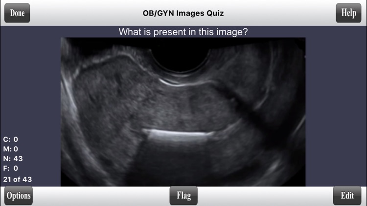 ARDMS OBGYN Ultrasound Flashcards for ARDMS OB/GYN Board Review