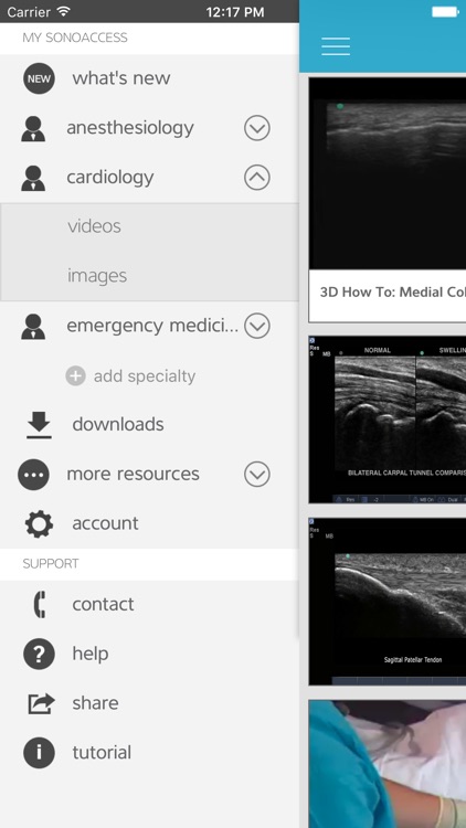SonoAccess