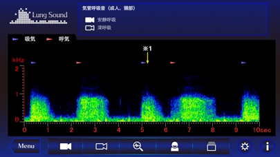 肺の聴診トレーニング - 見える肺音 screenshot1