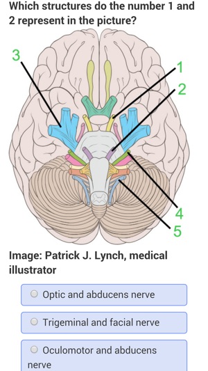 USMLE Neurology Review(圖2)-速報App