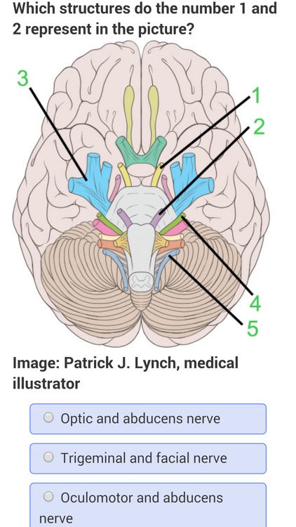 USMLE Neurology Review