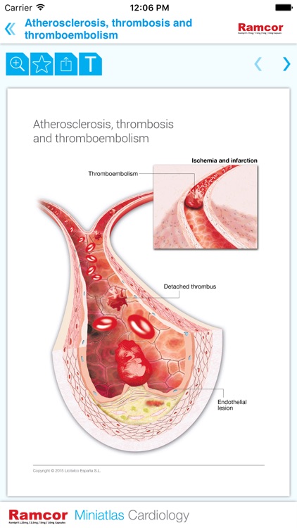 Cardiology Miniatlas