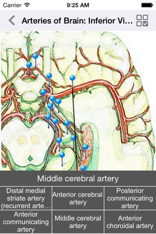 Isaiah cerebral vascular Atlas screenshot 3