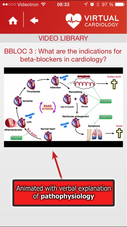 Virtual Cardiology by McGill University cardiologists and cardiologists from Université Laval screenshot-4