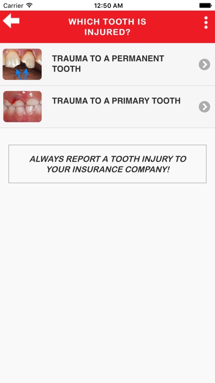 Dental Trauma