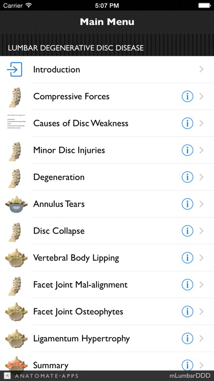 mLumbarDegenerativeDiscDisease