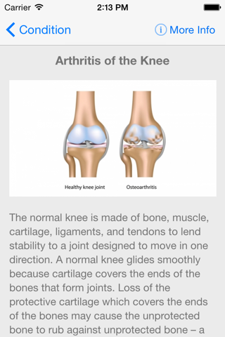 UCSF Center for Joint Replacement screenshot 4