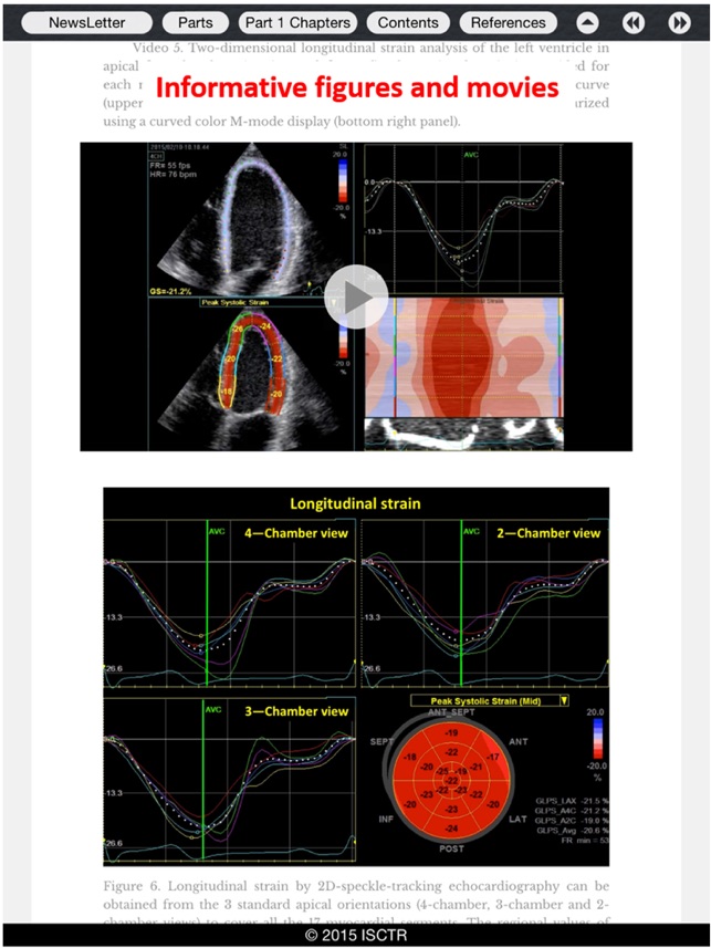 ISCTR - Cardiovascular Translational Research(圖3)-速報App