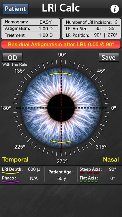 LRI Calc - Limbal Relaxing Incisions Calculator