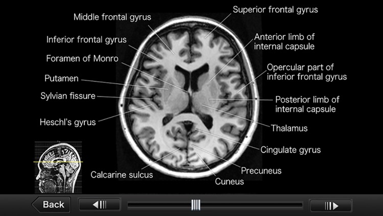 Interactive CT and MRI Anatomy by LibroScience, Inc.