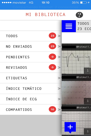 ECG Camera screenshot 2