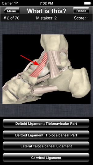 Anatomy Foot Quiz(圖5)-速報App