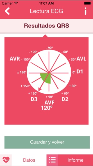 ECG Práctico(圖2)-速報App