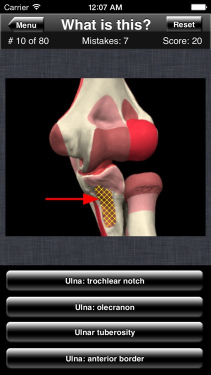 Anatomy Shoulder Quiz screenshot-4