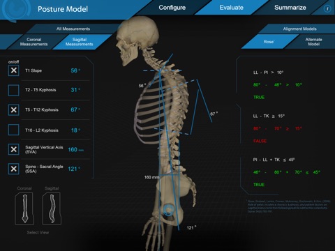 CATALYST™ Spino-Pelvic Posture Simulation screenshot 3