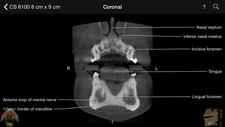 CBCT