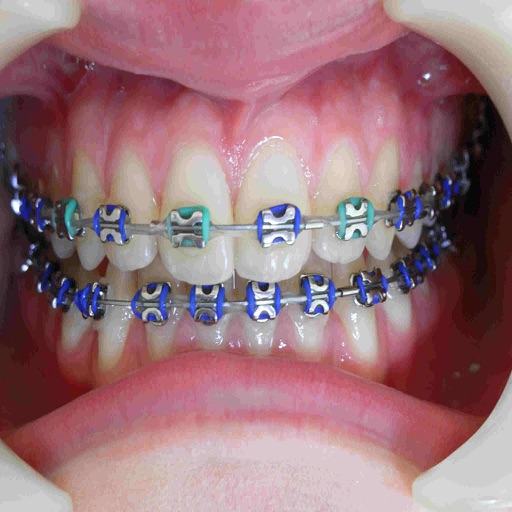 Orthodontic تقويم الاسنان
