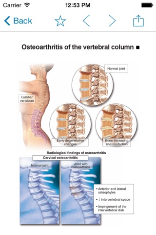 Miniatlas Diseases of the vertebral column screenshot 4